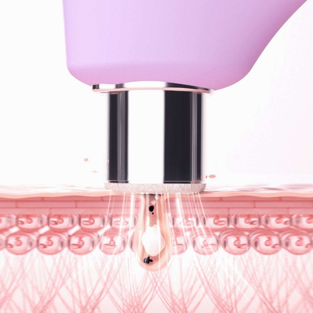KIWI™ derma Microdermabrasion Pore Vacuum F1955